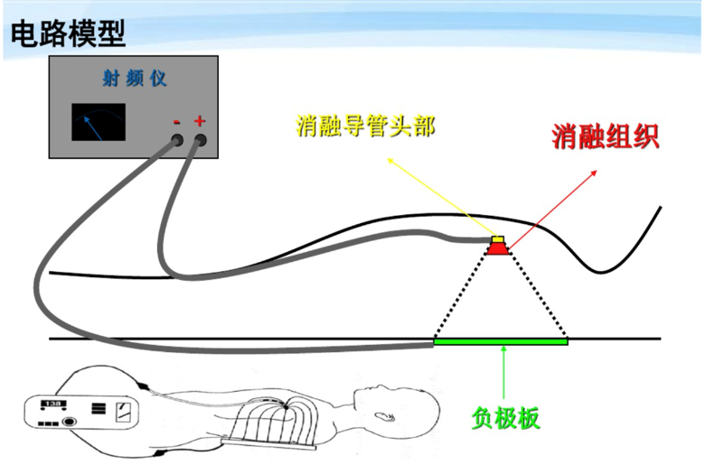 射频消融仪 原理图